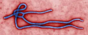 Electron micrograph of an Ebola virus virion.